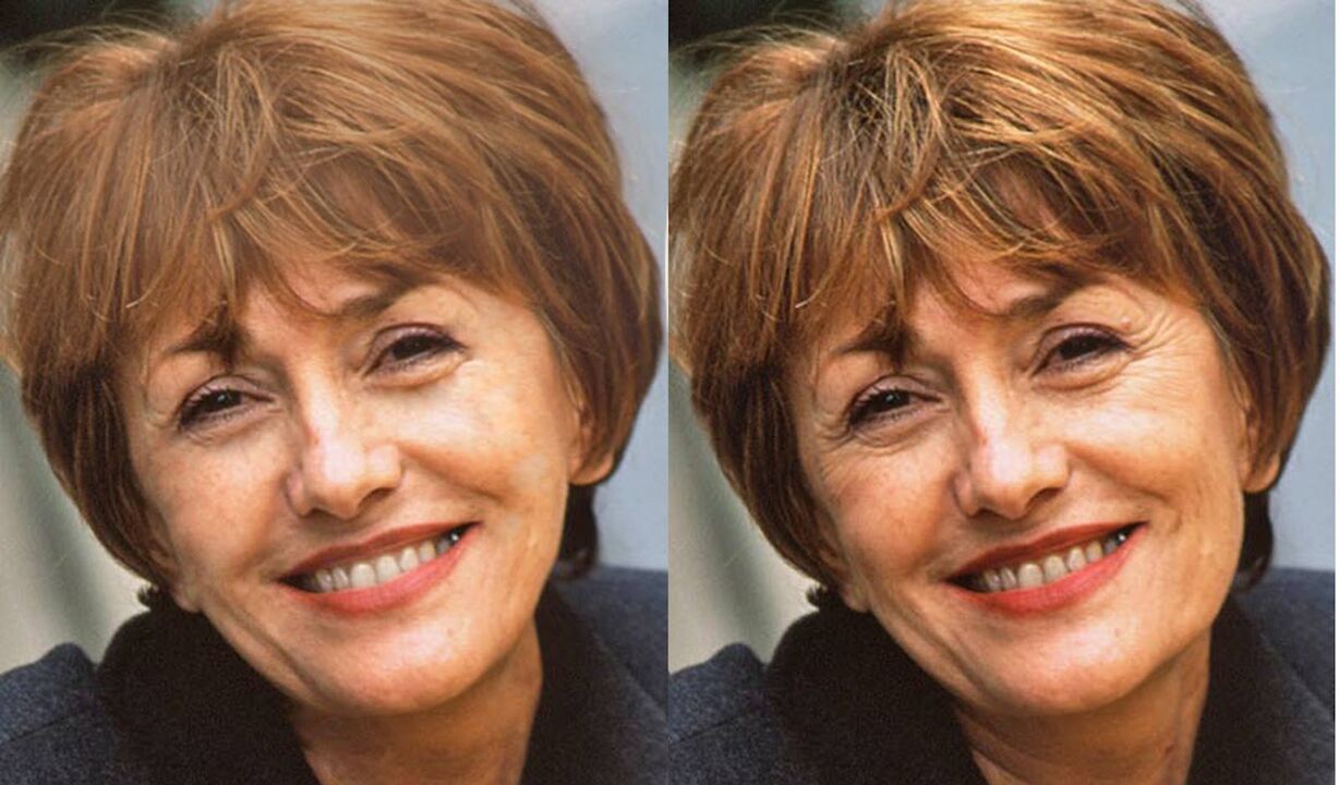 Gesichtsfoto vor und nach Kontur